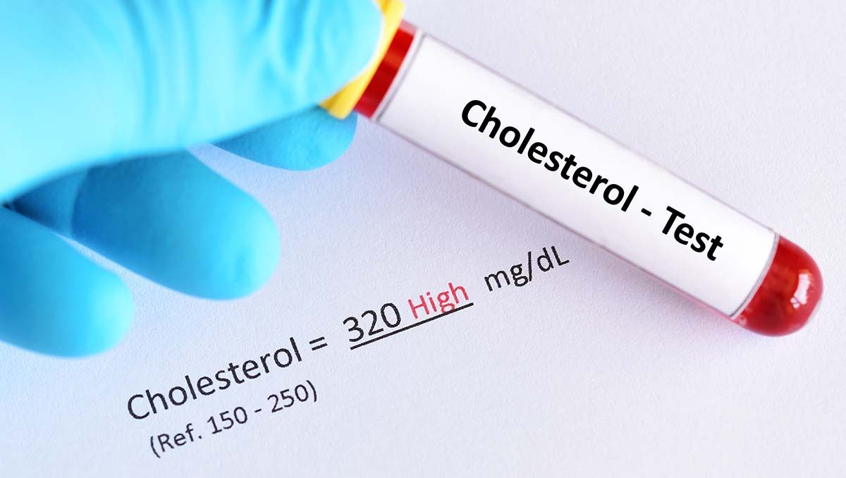 Las señales externas del colesterol alto
